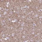 Immunohistochemical staining of human cerebral cortex shows strong granular cytoplasmic positivity in neuropil.