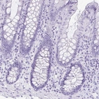 Immunohistochemical staining of human colon shows no positivity in glandular cells as expected.