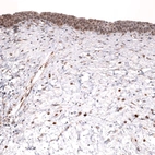 Immunohistochemical staining of human urinary bladder shows strong nuclear positivity in urothelial cells.