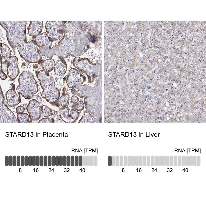Anti-STARD13 Antibody
