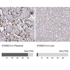Anti-STARD13 Antibody