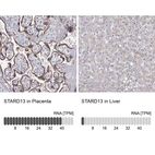 Anti-STARD13 Antibody