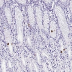 Immunohistochemical staining of human stomach shows strong cytoplasmic positivity in neuroendocrine cells.