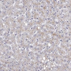 Immunohistochemical staining of human liver shows low expression as expected.