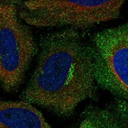 Anti-ASIC1 Antibody