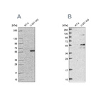 Anti-ACSBG1 Antibody