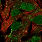 Immunofluorescent staining of human cell line SK-MEL-30 shows localization to nucleus & vesicles.