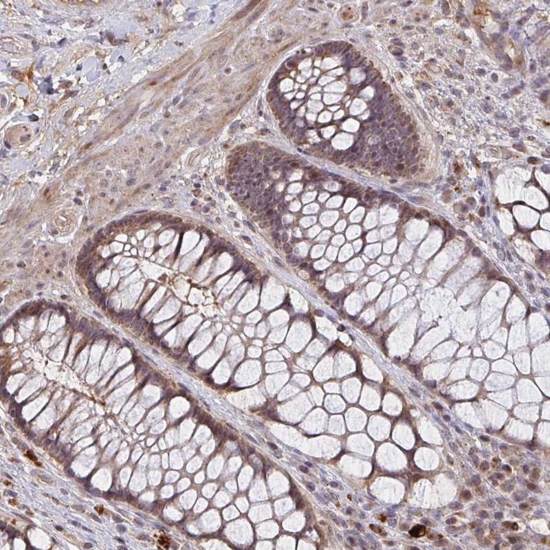 Anti-ZNF805 Antibody