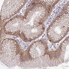 Immunohistochemical staining of human Stomach shows moderate cytoplasmic positivity in glandular cells.