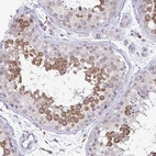Immunohistochemical staining of human Testis shows moderate cytoplasmic positivity in cells in seminiferous ducts.