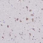 Immunohistochemical staining of human Cerebral cortex shows weak cytoplasmic positivity in neurons.