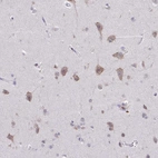 Immunohistochemical staining of human Cerebral cortex shows weak cytoplasmic positivity in neurons.