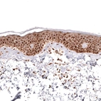Immunohistochemical staining of human skin shows strong nuclear positivity in squamous epithelial cells.