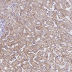 Immunohistochemical staining of human liver shows high expression.