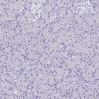 Anti-GAS2 Antibody