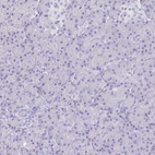Immunohistochemical staining of human pancreas shows low expression as expected.