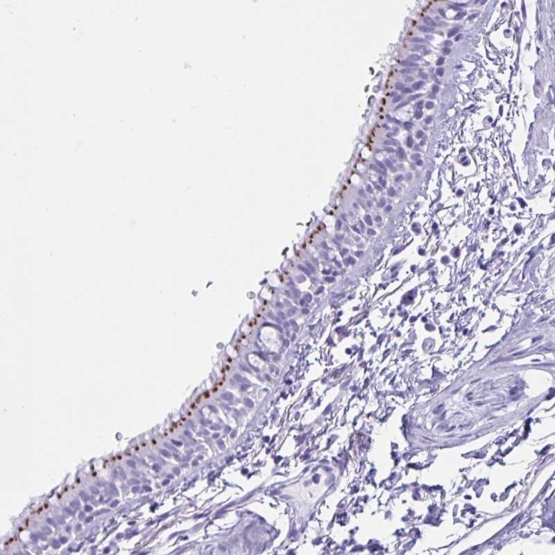 Anti-MRGPRG Antibody
