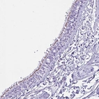Anti-MRGPRG Antibody