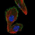 Immunofluorescent staining of human cell line PC-3 shows localization to plasma membrane.