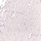 Anti-IL33 Antibody