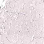Immunohistochemical staining of human skeletal muscle shows no positivity in myocytes as expected.
