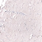 Immunohistochemical staining of human skeletal muscle shows no positivity in myocytes as expected.