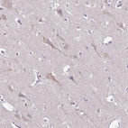 Immunohistochemical staining of human cerebral cortex shows moderate cytoplasmic positivity in neuronal cells.