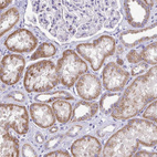 Anti-SAMD13 Antibody