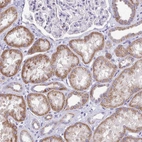 Immunohistochemical staining of human kidney shows strong cytoplasmic positivity in cells in tubules.