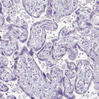 Immunohistochemical staining of human placenta shows no cytoplasmic positivity in trophoblastic cells as expected.