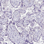 Anti-SAMD13 Antibody