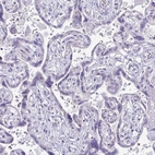 Immunohistochemical staining of human placenta shows no cytoplasmic positivity in trophoblastic cells as expected.