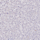 Anti-SAMD13 Antibody