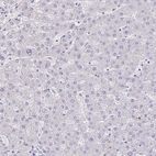 Immunohistochemical staining of human liver shows no cytoplasmic positivity in hepatocytes.