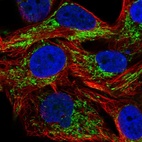 Immunofluorescent staining of human cell line SK-MEL-30 shows localization to mitochondria.