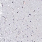 Anti-SHISA7 Antibody