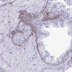 Immunohistochemical staining of human prostate shows moderate cytoplasmic positivity in glandular cells.