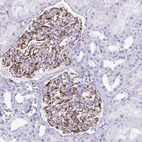 Immunohistochemical staining of human kidney shows strong cytoplasmic positivity in cells in glomeruli.