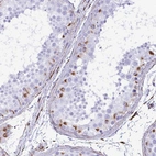 Immunohistochemical staining of human testis shows moderate cytoplasmic positivity in a subset of cells in seminiferous ducts.