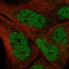 Immunofluorescence staining in EFO-21 cell line with Anti-IL33 monoclonal antibody, showing specific staining of nucleoplasm in green. Microtubule- and nuclear probes are visualized in red and blue respectively (where available).