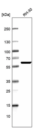 Western blot analysis in human cell line RH-30.