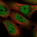 Immunofluorescent staining of human cell line U-251 MG shows localization to nucleoplasm & cytosol.
