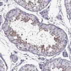 Immunohistochemical staining of human testis shows high expression.