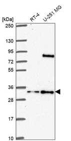 Western blot analysis in human cell line RT-4 and human cell line U-251 MG.