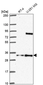 Western blot analysis in human cell line RT-4 and human cell line U-251 MG.