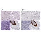 Anti-KRT25 Antibody