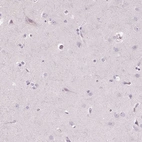 Immunohistochemical staining of human cerebral cortex shows no positivity in neuronal cells as expected.