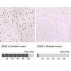 Anti-ZEB2 Antibody