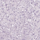 Immunohistochemical staining of human liver shows no positivity in hepatocytes as expected.