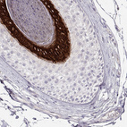Immunohistochemical staining of human skin, hairy using Anti-KRT25 antibody HPA058943.